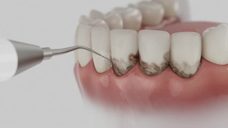 Trusted Emergency Dentist service in Mount Pleasant, SC - Dentist Open Now